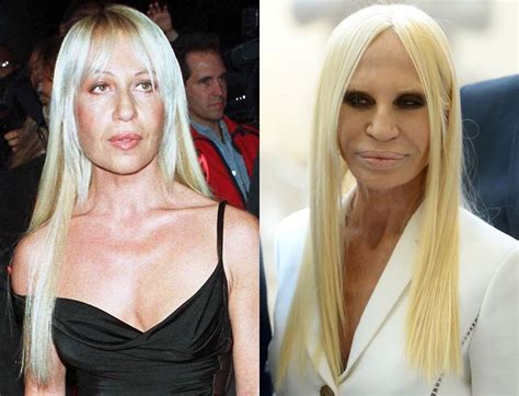 does donatella versace design|Donatella Versace before and after.